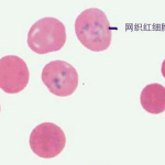 网织红强度,揭秘血液健康的关键指标